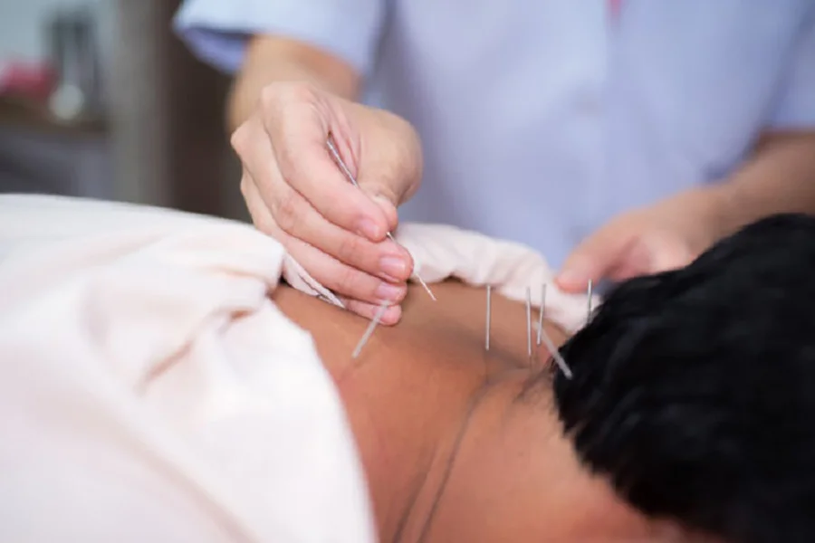 Top 5 Địa Chỉ Châm Cứu, Bấm Huyệt Uy Tín Ở TP. Vinh